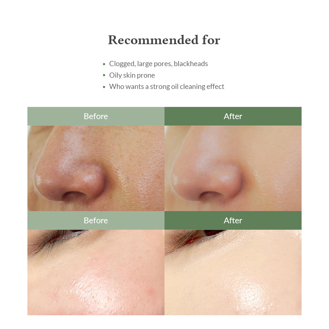 Premium Quick Step Sebum Cleanser