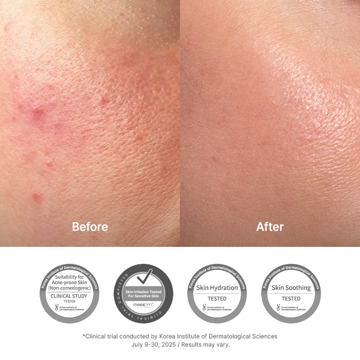 345 Relief Cream