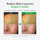 Post Acne Care Set (Gentle) | 345 Relief Cream & Gentle Vitamin C Serum