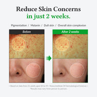 Post Acne Care Set (Gentle) | 345 Relief Cream & Gentle Vitamin C Serum