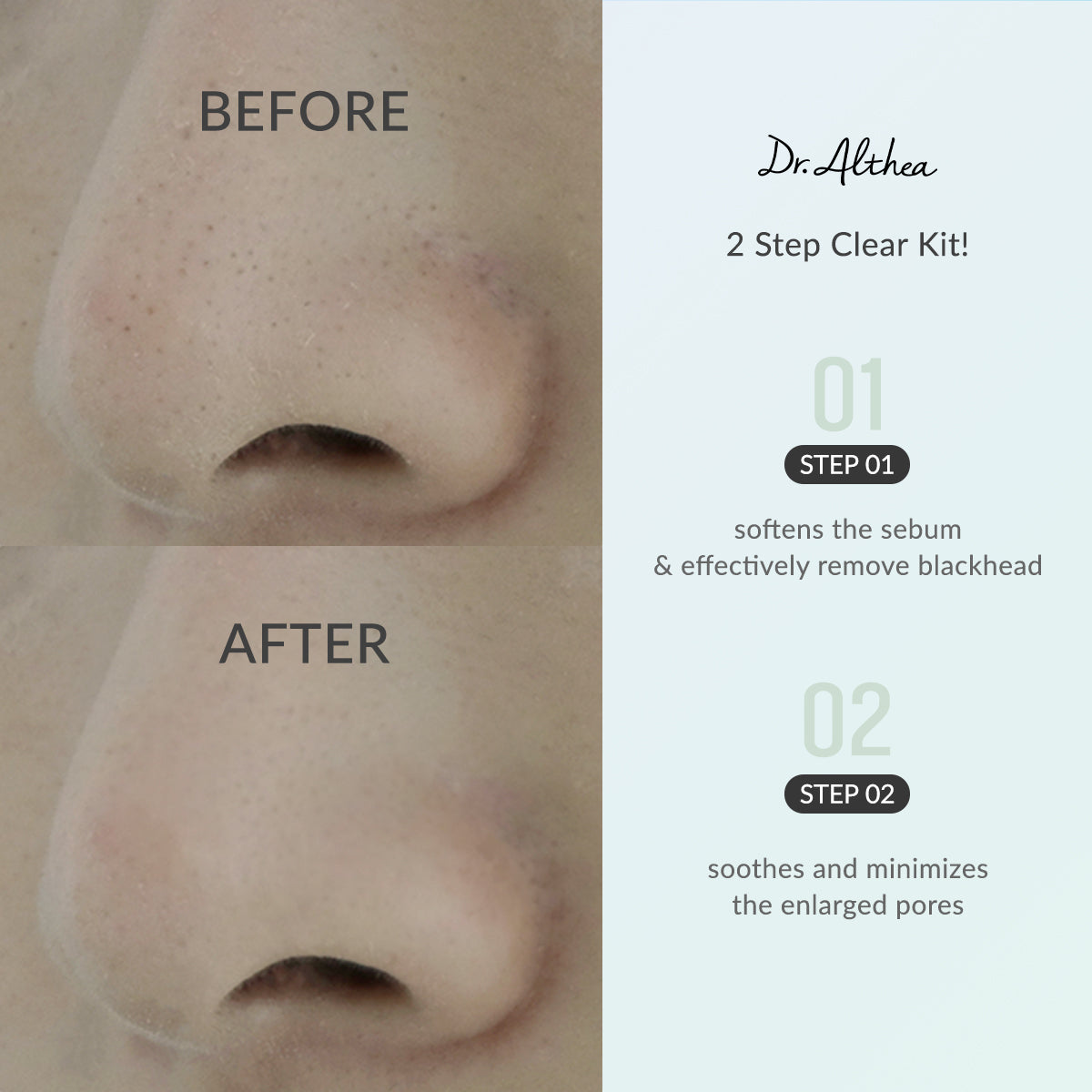 Blackhead Zero 2 Step Nose Patch